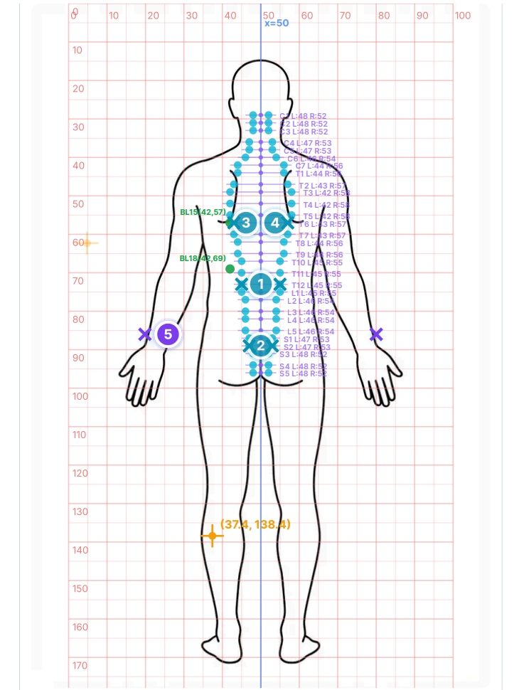 TAP Body Map — Chronic LBP electrode placement